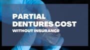 How Much Do Partial Dentures Cost Without Insurance