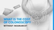 What Is the Cost of Colonoscopy Without Insurance