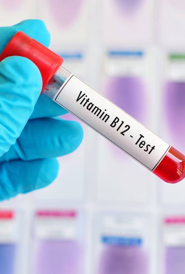 Do You Need a Prescription for B12 Injections