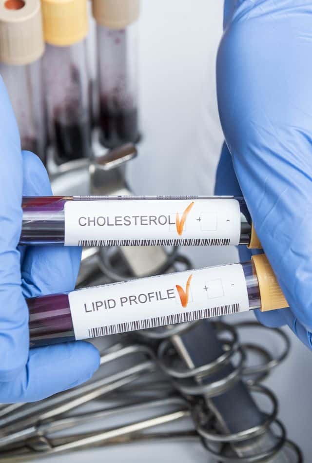 Hyperlipidemia ICD-10