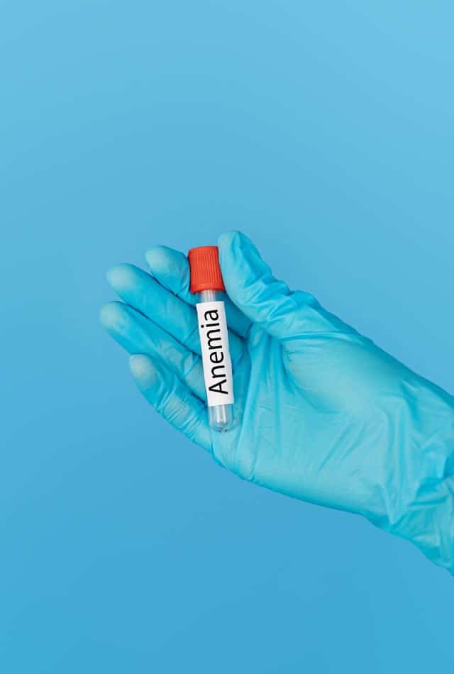 ICD-10 Anemia