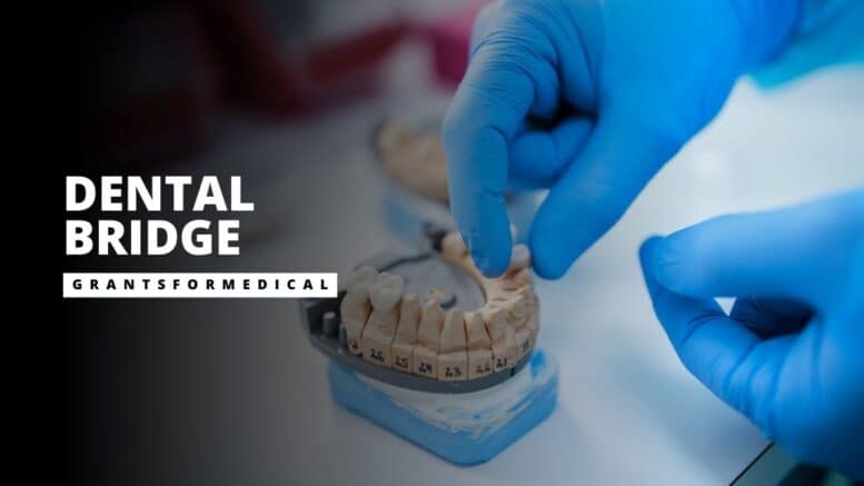 What is a Dental Bridge