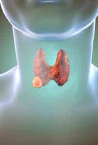 ICD-10 Dysphagia - Grants for Medical