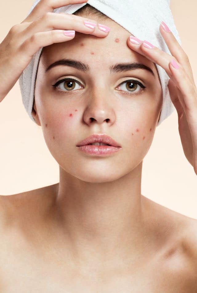 Shingles Vaccine Side Effects