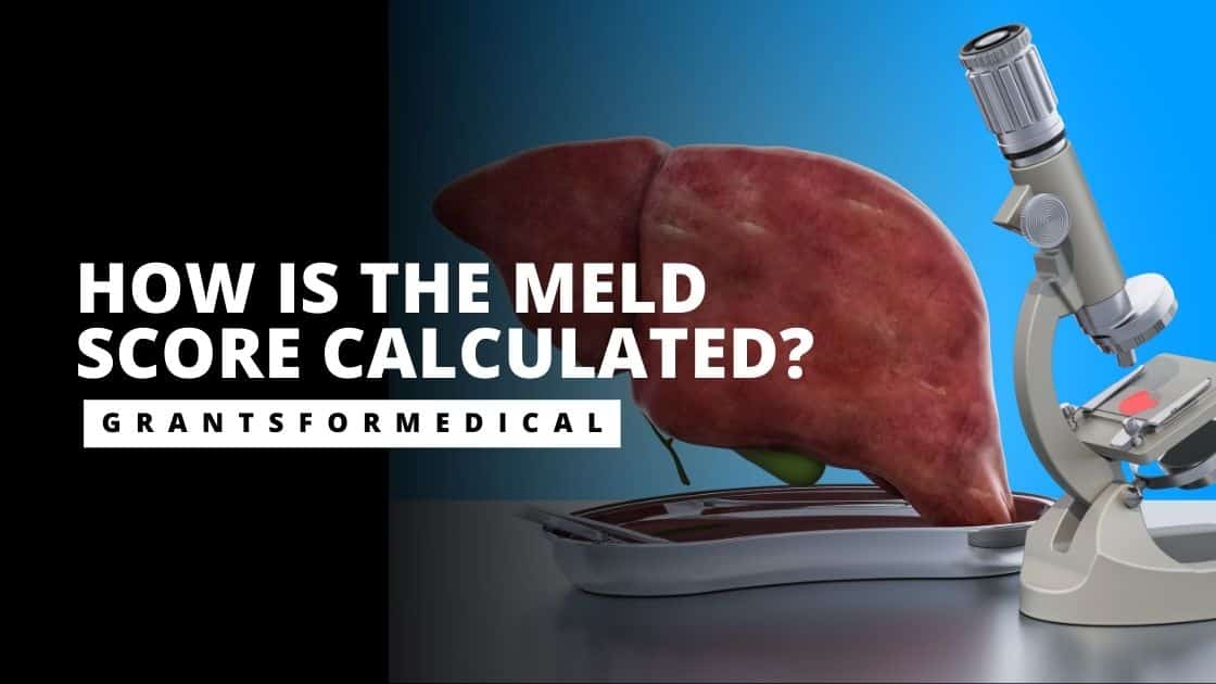 meld score 12 life expectancy