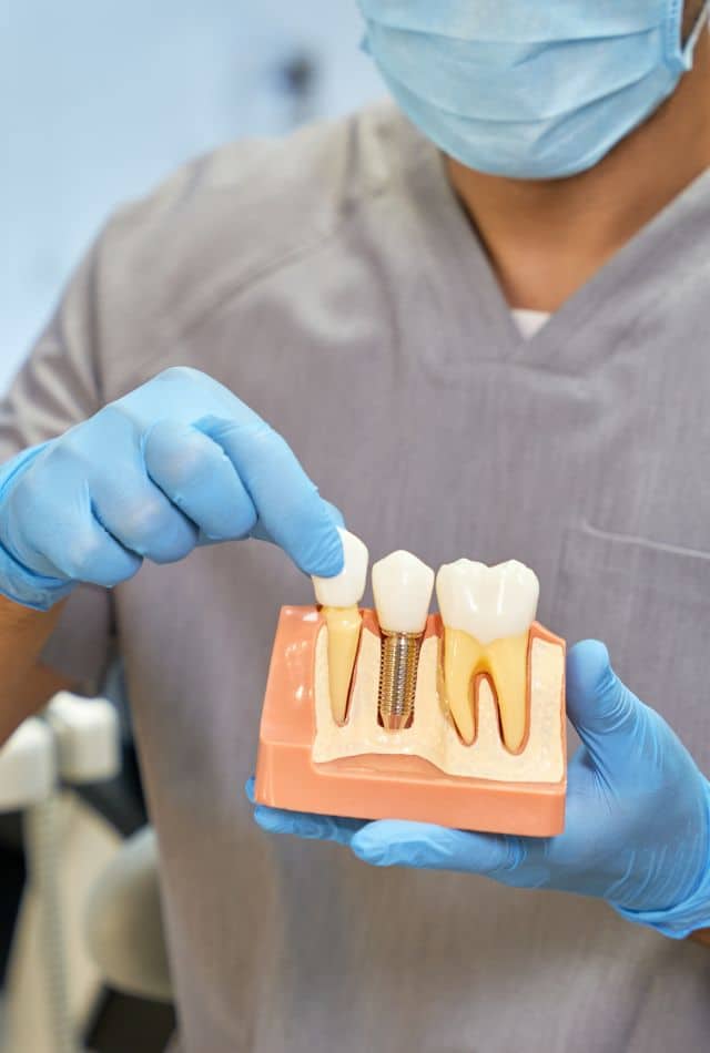 Dental Implants Grants in Louisiana Dental Implants Grants in Louisiana