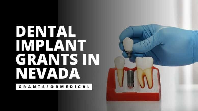 Dental Implant Grants in Nevada