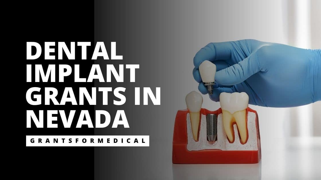 Dental Implant Grants in Nevada
