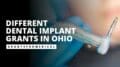 Dental Implant Grants in Ohio