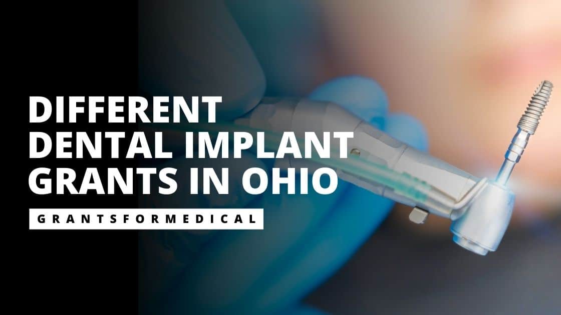 Dental Implant Grants in Ohio
