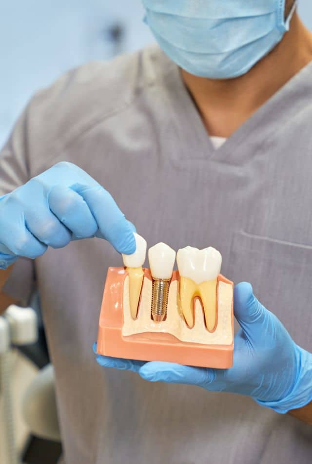 Dental Implants in Nevada